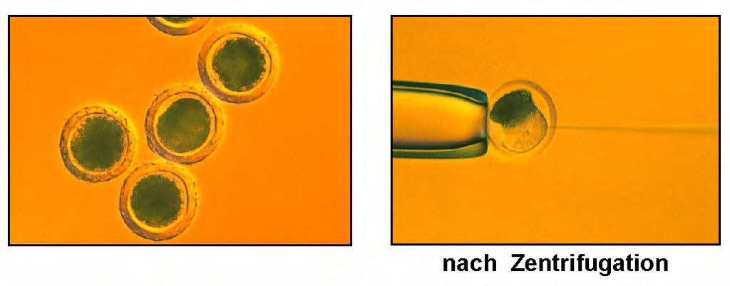 78 grund für diese Forschung ist, dass die Allotransplantation, d. h.