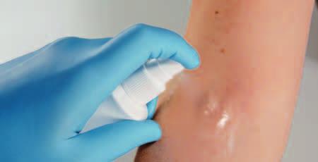 Hautverträglichkeit praktische dank Überkopf-Sprühsystem Cutasept F empfiehlt sich in folgenden Einsatzgebieten: vor Injektionen, Punktionen und operativen Eingriffen in Krankenhaus, Arztpraxis,