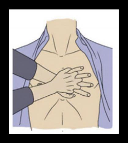4 CPR - Beatmung - AED CPR beginnen Circulation Druckpunkt untere Sternumhälfte Helferposition