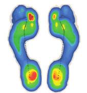 mit speziell stützenden Sport-/ Laufschuhen versucht, einer Überpronation entgegenzuwirken. Die COMPRESSANA Pronation Control TAPE SOX unterstützen das Fußgewölbe im Sportschuh und im Alltag.