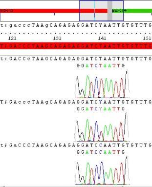 In der nachfolgenden Abbildung 3.4 sind die SNPs in Intron 3 und 4 nebeneinander zu sehen. Abbildung 3.4: Sequenzausschnitte der gekoppelt auftretenden Varianten c.