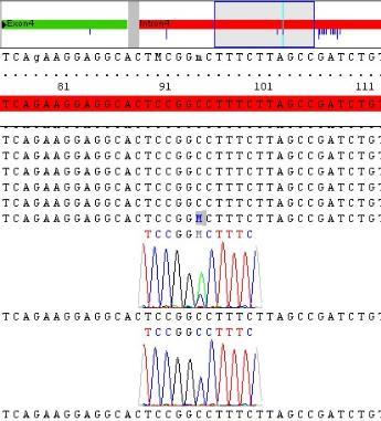 Abbildung 3.5: Sequenzausschnitt aus Intron 4 des ELOVL5-Gens, : Sequenzvariante c.
