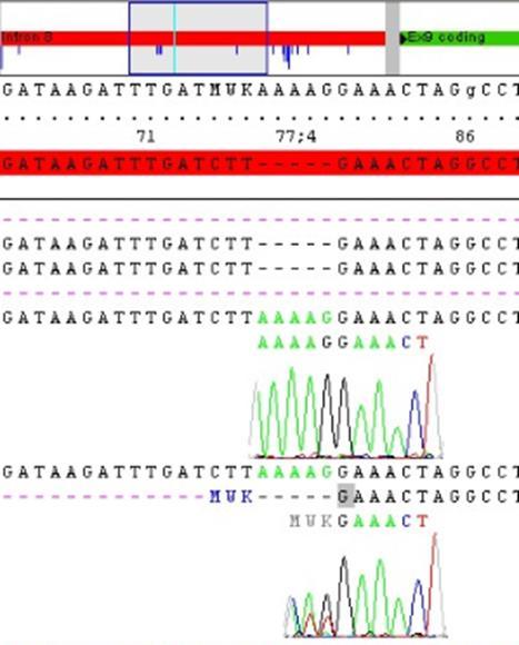 Abbildung 3.13: Sequenzausschnitt Intron 8 des ELOVL5-Gens, : Variante c.838-97_838-96insaaaag, homozygot (Probe 642), : Variante c.838-97_838-96insaaaag, heterozygot (Probe 723). c.942 G>T p.