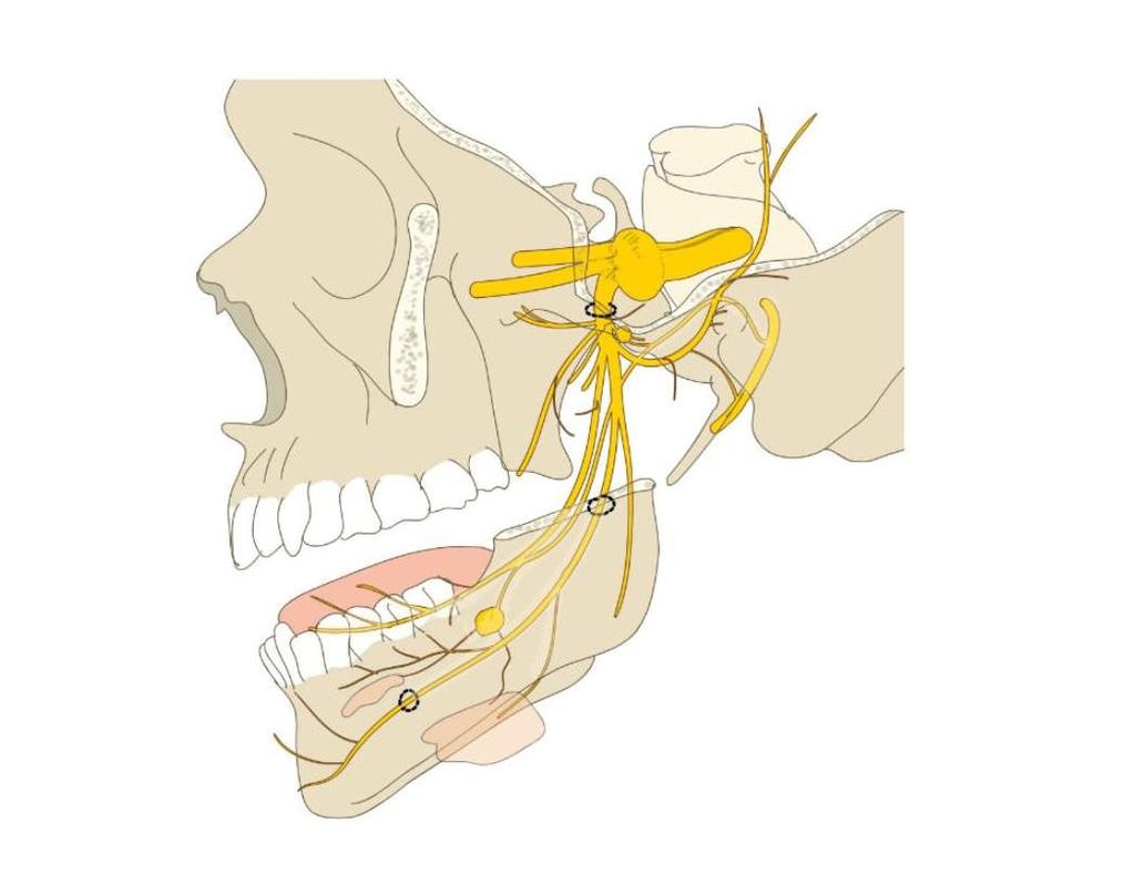 Schmerz in der maxillofazialen Region Die Reize der