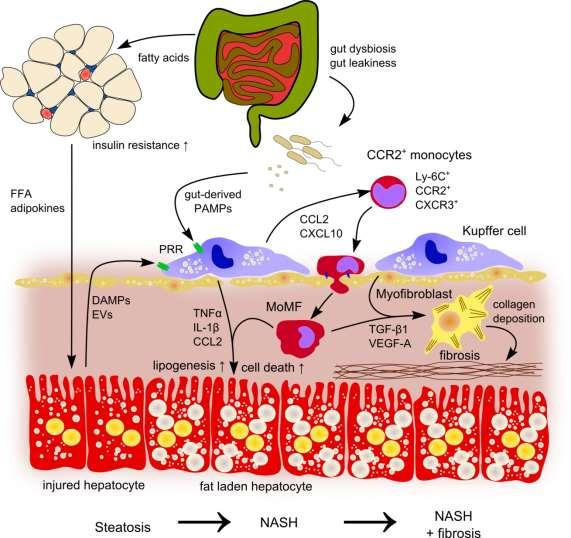 Neuer immunologischer Ansatz: Monozyten / Makrophagen in Fettleber und Fibrose lymphocytes hepatic stellate cells Steatosis NASH