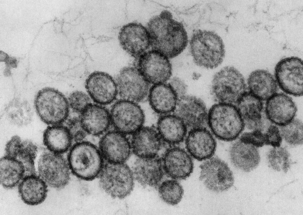 LUA-Bilanz InfektionsPrävention Zahlen, Daten und Fakten für das