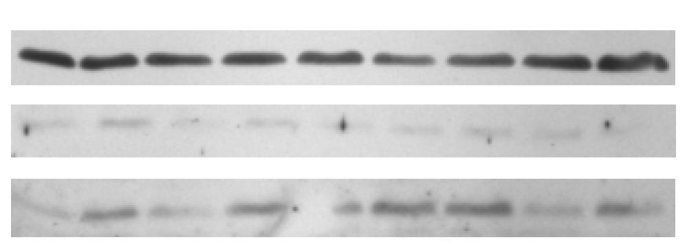 adrenerg-stimulierten Zellen zu untersuchen, wurde die Gesamtproteinexpression der SERCA2A und von PLB sowie der Phosphorylierungsgrad von PLN-Ser16/PLN und PLN-Thr17/PLN mit Hilfe von