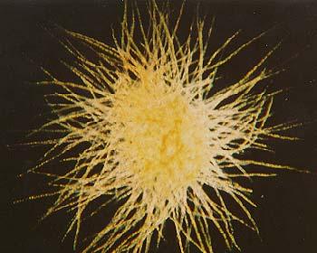 !! Trichodesmium (cyanobacteria) Cyanobacteria are aquatic and