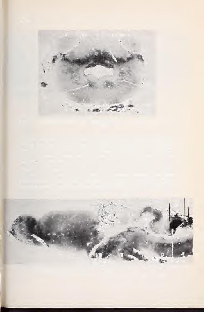 Heft 4 26/1975 Gehirn von Hyla arbórea 379 Abb. 7: Frontalschnitt durch das Cerebellum und die Regio subcerebellaris.