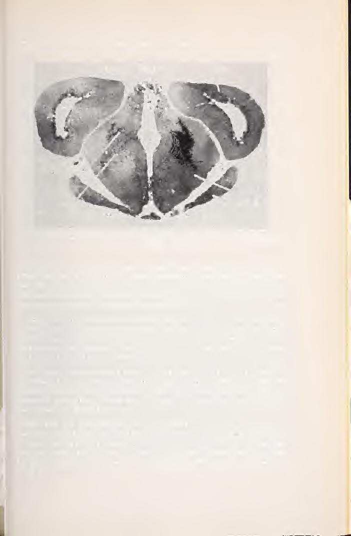 Heft 4 26/1975 Gehirn von Hyla arbórea 375 2. Diencephalon: Das zylinderförmige Zwischenhirn bildet zwischen Vorder- und Mittelhirn eine Einschnürung.