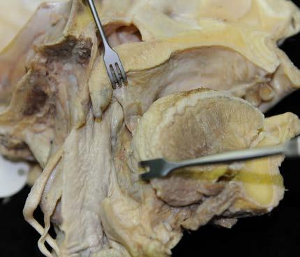 Pharynx und Larynx tief: Arcus palatoglossus (), Arcus