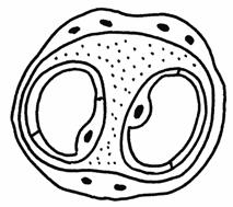 Seite Amnion Zottenbaum Chorionplatte Nabelschnur Intervillöser Raum Myometrium Basalplatte Spiralarterie
