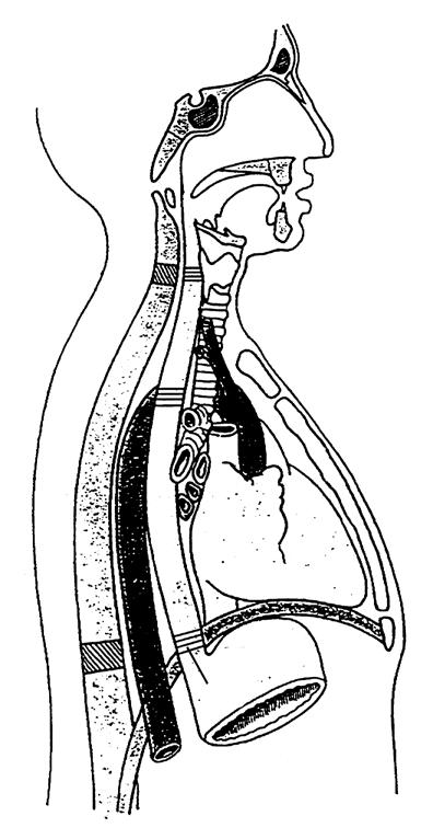 Schluckakt und Speiseröhre A Schluckakt a Epi- (Naso-) b Meso- (Oro-) c Hypo- (Laryngo-) -Pharynx 3 b a Nasenhöhle Tuba auditiva 2 1 5 c 4 Fettkörper