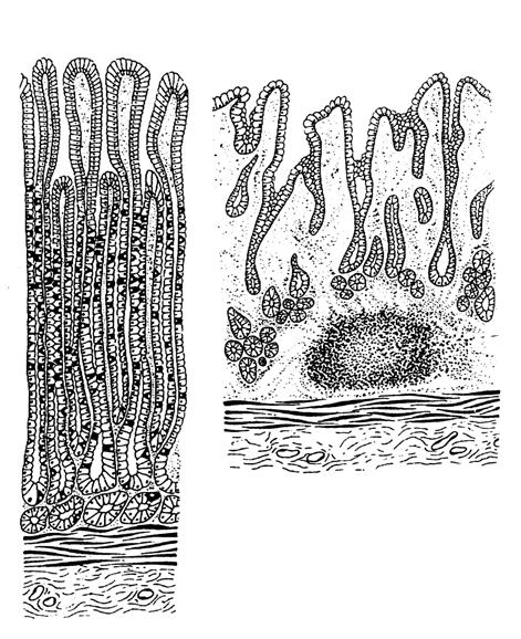 gastrica Lamina propria mucosae Magenabschnitte 5 3 1 2 5 4 3 2 1 4 3 2 1 5 2 1 Verschiedene Magenformen im Stehen (1 Fundus, 2 Corpus, 3 Antrum, 4 Pylorus, 5 Duodenum)