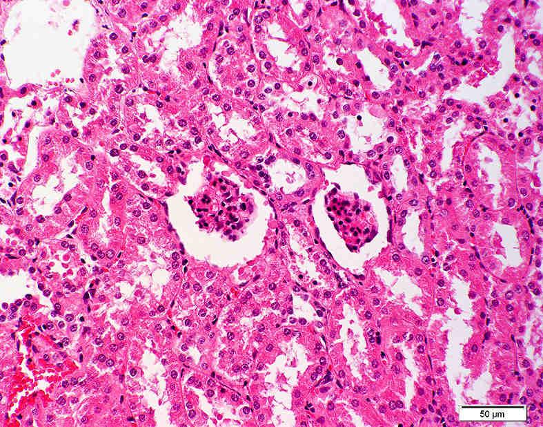 58: Nierenrinde einer Niere mit Hypoplasie und/oder Dysplasie: multifokal Nachweis kleiner Nierenkörperchen (N) mit einem dichten, nicht entfalteten Glomerulum ( );