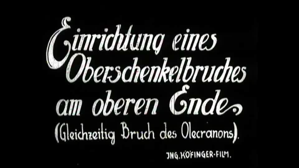 Unfallkrankenhaus Wien, 1932 Hüftnahe Frakturen 70% aller Femurfrakturen im hüftnahen Drittel 77% der