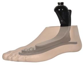 FÜSSE MOB 2-3 Füße Modularteile Kniegelenke AERIS FUSS Mobilität: 2-3 Konstruktion: Gelenkloser Prothesenfuß mit separater Kosmetik Keel: Carbon Fersenauftritt: Fest Vorfuß: Mittlere Energierückgabe