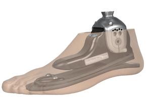 FÜSSE MOB 2-3 Füße Modularteile Kniegelenke MOTION MX FUSS Mobilität: 2-3 Konstruktion: Prothesenfuß mit hydraulischem Knöchelgelenk Keel: Carbon Fersenauftritt: Stufenlos einstellbar Vorfuß:
