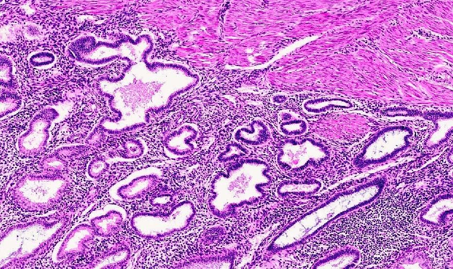 Myometrium Basalis (zwischen den Pfeilen) Sägeblatt-Kontur der Drüsentubuli