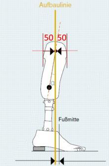 Aufbau Unterschenkelprothese Sagitalebene Die Aufbaulinie wird aus der Mitte des Schaftes (50:50 Höhe Patellaband) gefällt, gleichgültig wie der Schaft im Raum steht Flexionskontrakturen werden nach
