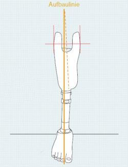 (individuelle Flexionsstellung + 5 ) Die Aufbaulinie durchläuft den Fuß im hinteren Anteil des mittleren Drittels der Fußlänge Diese Einordnung berücksichtigt die effektive Absatzhöhe des Schuhes