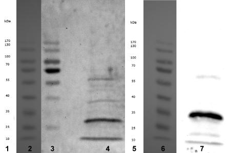 Ladder im Western Blot; 4: Western Blot: Positives H. contortus-serum, Meerrettichperoxidase-konj.-Kaninchen-Anti-Schaf-Antikörper; 7: Western Blot: Anti-V5- Antikörper, Meerrettichperoxidase-konj.