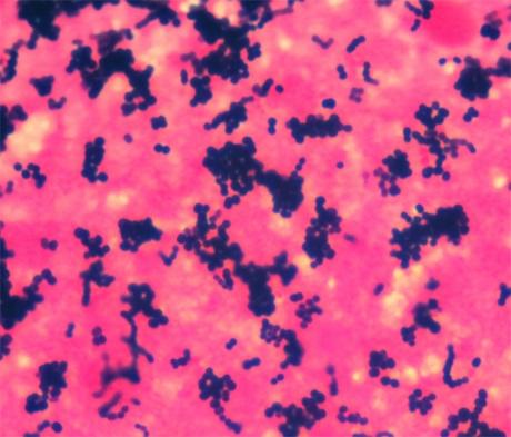 Staphylococcus aureus Toxine: Poren-bildende Toxine: PVL PVL-assoziierte Infektionen Nekrotisierende Pneumonie Trachealsekret Diagnostik schnelle klinische Einordnung Nachweis des Toxin-bildenden S.