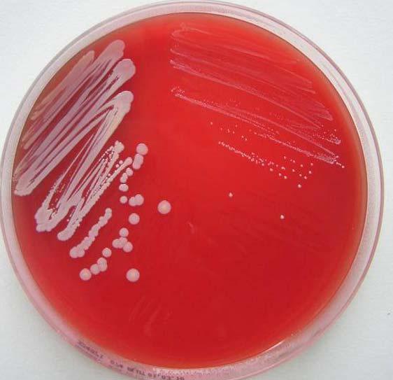 Staphylococcus aureus Invasive Infektionen: SCV-Bildung und chronische Infektionen Wild-Typ Phänotyp Small colony variant (SCV) Phänotyp Das Auftreten von SCVs ist mit verschiedenen Arten von