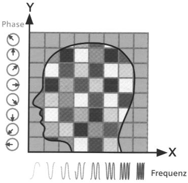 13 Mit der HF- Anregung der Spins, der Schichtselektion, der Phasencodierung und der Frequenzcodierung ergibt sich eine komplette Pulssequenz 1.