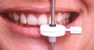Diagnose der Zahnlängen zu bewerten.