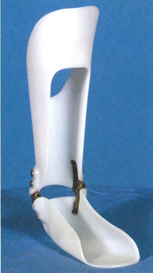 Orthese bei Kauergang zur Streckung des Kniegelenks GRAFO: ground reaction ankle-foot orthosis streckt das Kniegelenk in der