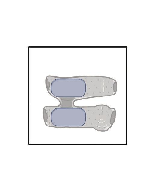 3 4 5 6 Abbildung 11-11: Austauschen der Oberschenkel-Gewebeelektroden Abnehmen des Stimulators Unter- und Oberschenkel-Stimulator sollten nur zu Wartungszwecken und zur Reinigung der Unterschenkel-