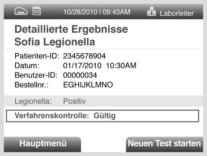 Siehe Abschnitt Auswertung der Ergebnisse Zum Beispiel: Dieser Bildschirm zeigt eine verbleibende Zeit von 7 Minuten und 13 Sekunden für den Test im Modus WALK AWAY.