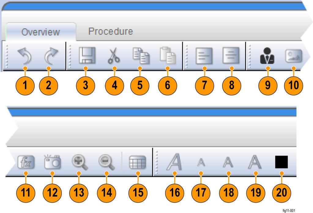 Abbildung 10: Über die Registerkarten Overview (Übersicht) und Procedure (Verfahren) ist eine Symbolleiste mit einer Vielzahl von Bearbeitungswerkzeugen verfügbar 1. Schritt zurück 8. Rechtsbündig 15.