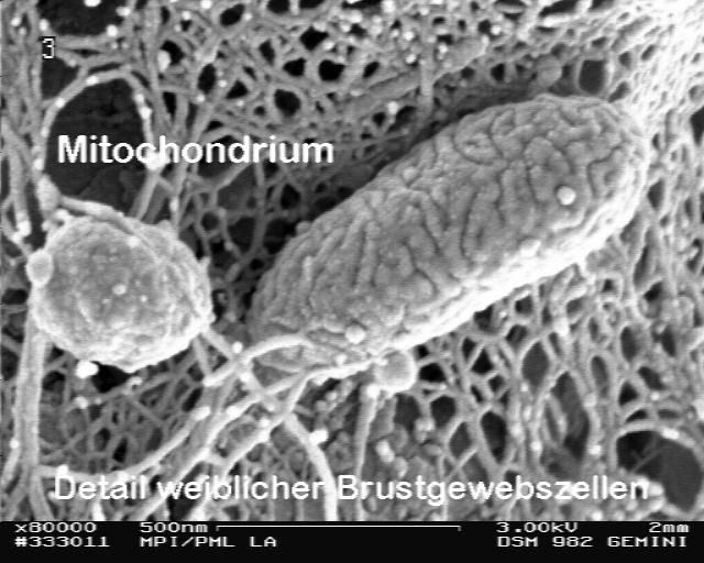 Mitochondrium Detail weiblicher Brustgewebszellen Beispiel aus der Zellbiologie: Bei Bei dieser dieser FE FE --REM REM --Untersuchung Untersuchung an an gezüchteten gezüchteten Mama-Karzinom