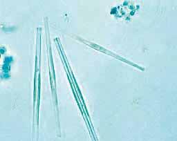 Rauschelesee Fragilaria acus (Kieselalge), Foto G. Deisinger Hygienische Beurteilung Von 5 bakteriologisch untersuchten Proben waren 4 einwandfrei.