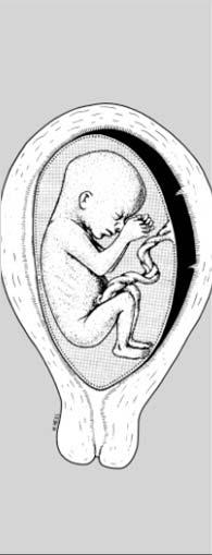 Nährstoffarme Umgebung Fetal