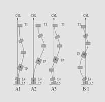 Zur genauesten Beurteilung der Gesamthaltung der Wirbelsäule ist Folgendes erforderlich: Die Darmbeinkämme müssen initial am unteren Rand der Aufnahme miteinbezogen wergredienzbestimmung gemessen