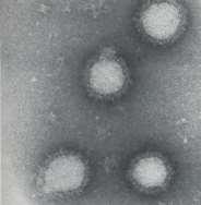 Hepatitis C-Virus (HCV) 1989 identifiziert (bis heute nicht in Zellkultur anzüchtbar) mindestens 12 Genotypen (und jeweils mehreren Subtypen z.b. 1a, 1b, 2a,.