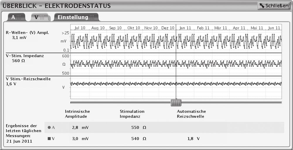 Systemdiagnostik Elektrodenstatus 3-9 [1] Wählen Sie die gewünschte Elektrode mit Hilfe der Register aus [2] Ergebnisse für den gewählten Tag [3] Ergebnisse des letzten Tages [4] Anpassung der Y-