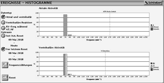 2-52 Stimulations-Therapien Frequenzadaptive Stimulation und Sensor Trendanalyse Abbildung 2 33.