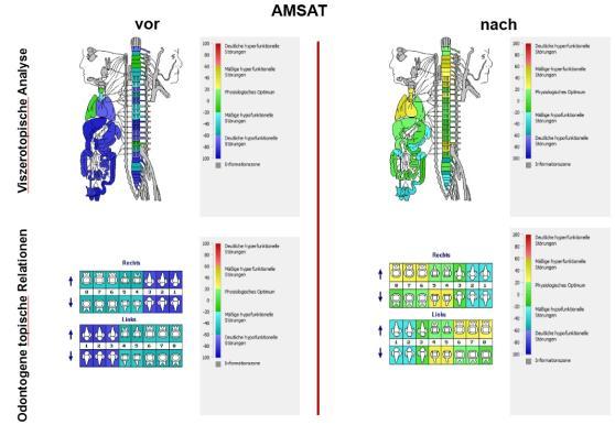 Systeme aus der Raumfahrtmedizin AMSAT Das Amsat benutzt eine Regulations-Diagnose von elektrophysiologischen Parametern biologisch aktiver Reflexzonen der Haut und damit verbundener Strukturen,