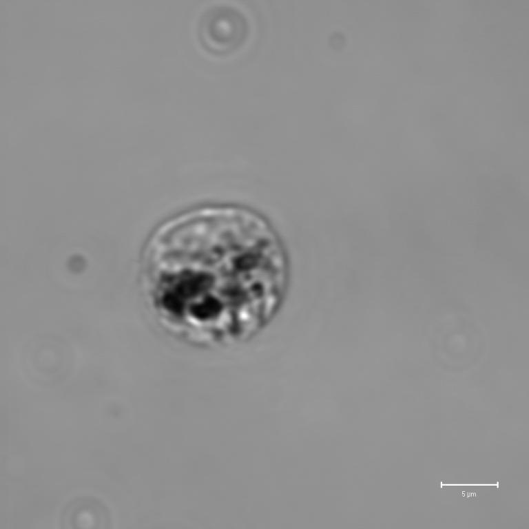 3 lässt gut erkennen, dass die Umrisse des granulären, schwarzen Melanines in der Zellmitte am schärfsten sind und DAM von der Zelle