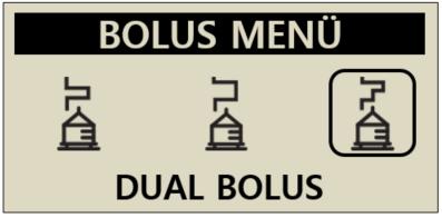 Sie auszuwählen:, um die Bolus-Art Einzel-Bolus (Siehe Abschnitt 5.1) Verzögerungs-Bolus (Siehe Abschnitt 6.