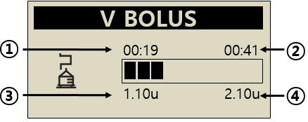 Verbleibende Bolus-Menge Drücken Sie, um das Menü zu verlassen. Verzögerungs-Bolus stoppen 1. Drücken Sie in der Anzeige V BOLUS.