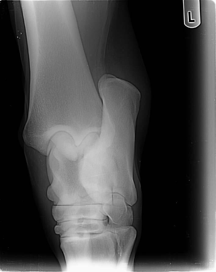 42 Fall 29: Insertionsdesmopathie am Fesselträgerursprung mit Knochenausriss am linken Tarsus bei einem 8-jährigen Warmblutwallach Abb.