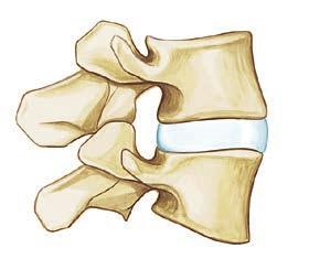 Implantate Für eine verbesserte Abdeckung der vertebralen Endplatten stehen zwei verschiedene Implantatgrößen zur Verfügung: M und L 3453 mm Größe M: 27 mm