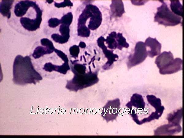 Listeria