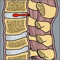 2 Starke Bänder an der Vorder- und Rückseite verbinden die Wirbel und Bandscheiben miteinander. Nach dem Prinzip der Zuggurtung werden die Halswirbel an der Rückseite über starke Bänder verbunden.