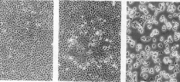 Zellveränderungen 1. Zellablösung + Pyknose 2. Bildung von: Synzythien od. Riesenzellen 3.